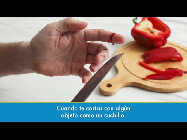 como cortar la sangre de un corte