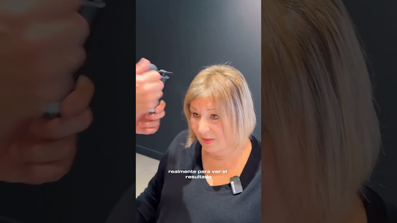 alopecia femenina disimular poco pelo mujer