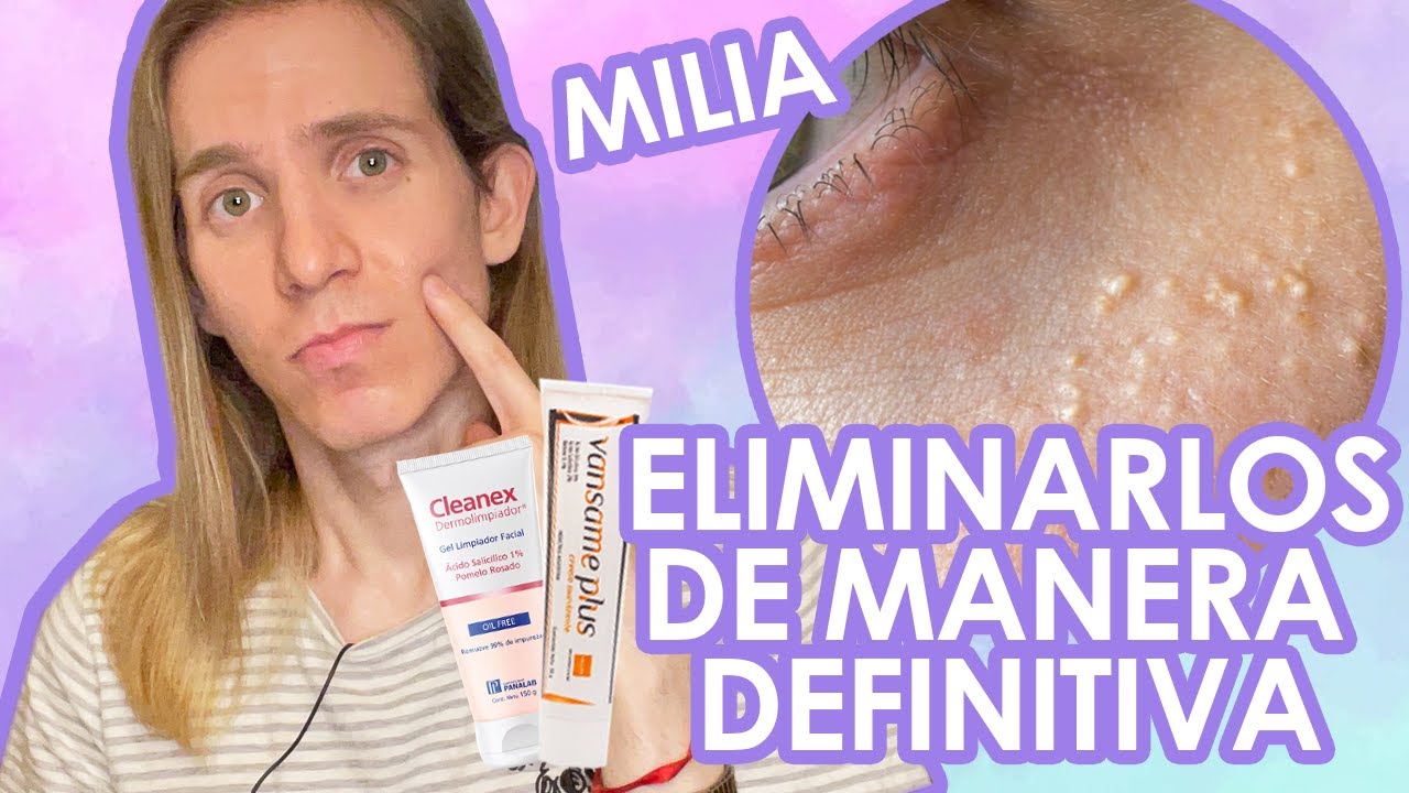 como quitar milium de la cara con aguja