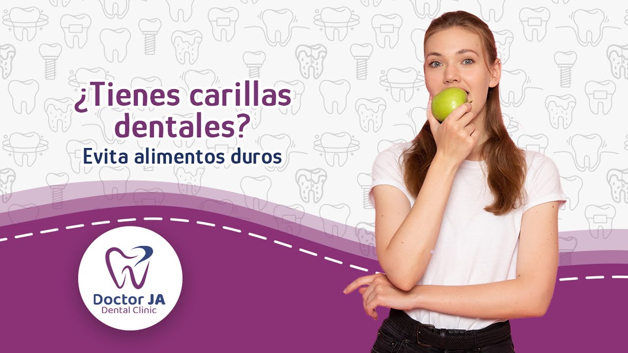 se pueden comer bocadillos con carillas