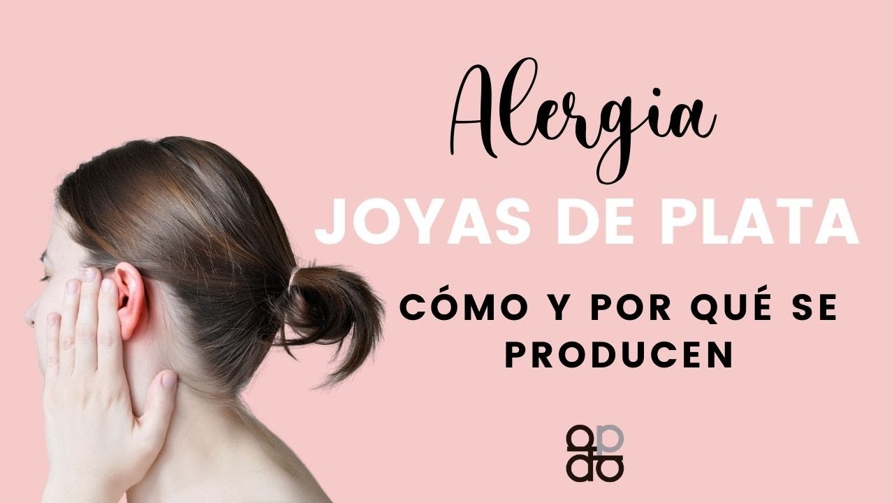porque me da alergia la plata